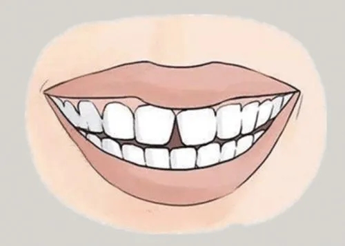 <a href=http://m.csqiang.cn/news_article?news_id=116>一次性口腔探針</a>